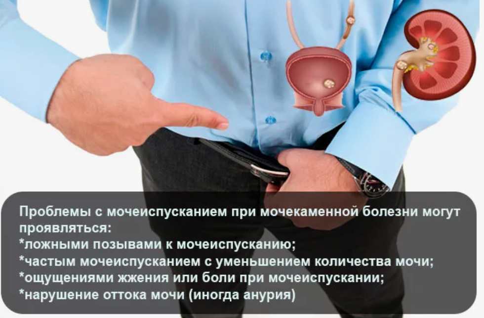 Anatomie der männlichen Harnwege