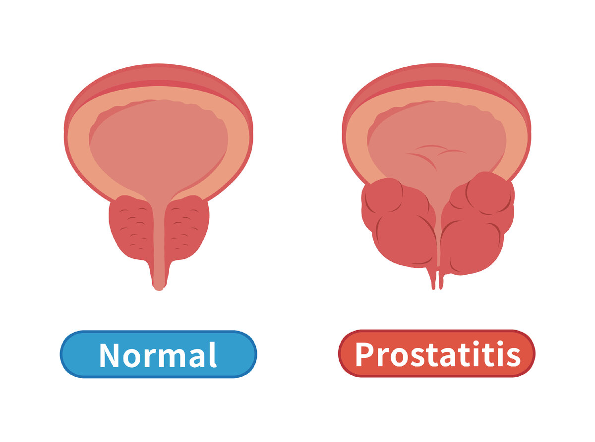 Anatomie des männlichen Beckens und der Prostata